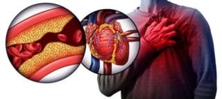 تاثیر فشار خون بر قلب: علل، عوارض و راه‌های پیشگیری