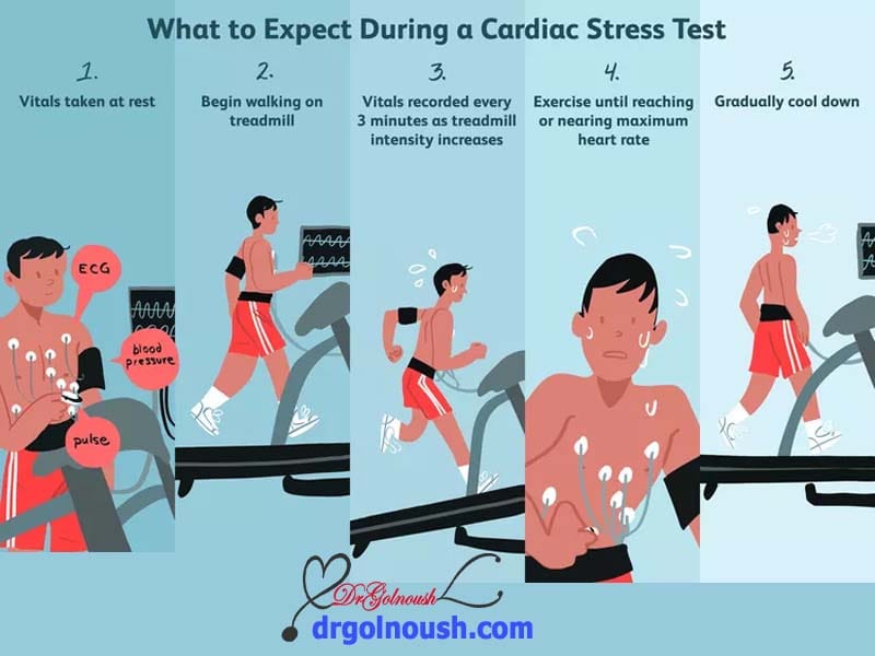 cardiac-stress-test.jpg
