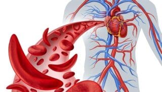 کم خونی, تأثیر کم خونی بر قلب, علائم کم خونی, کم خونی و سلامت قلب, پیشگیری از کم خونی