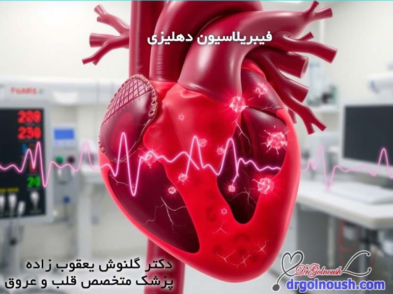 -دهلیزی.jpg